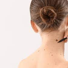 Neck Grooming
